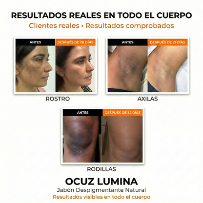 Ocuz lumina Kojic Pack X2