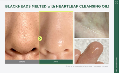 Anua Heartleaf