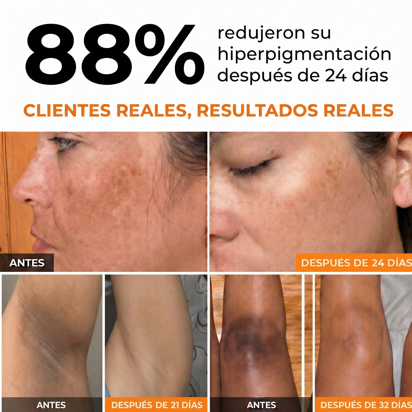 Ocuz lumina Kojic Pack X2